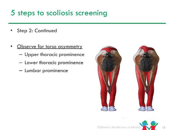 Slide 15 Look for: High thoracic prominence Low thoracic prominence Lumbar