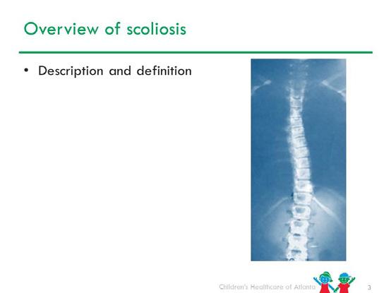 Slide 3 Description: Scoliosis is a lateral or sideways deviation or curve from the normal vertical line sagittal plane of the spine, which when measured by X-ray is greater than 10 degrees.
