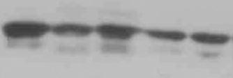 A DAPT - + + - - DBZ - - - + + HES B 8 6 EN GVP reporter DMSO DAPT DBZ Figure S. Notch inhibitors decrease Notch activation. (A) Western blot analysis of HES from DAPT and DBZ treated HepG cells.
