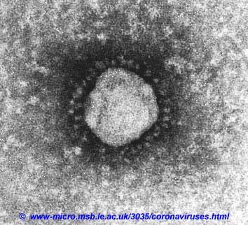 Human coronaviruses: common cold viruses (+) RNA genome, 30 Kb Discovered early 60 s after inoculation of material of human common cold on human embryoric