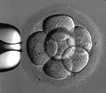 A high quality day 3 human embryo at the 8-cell