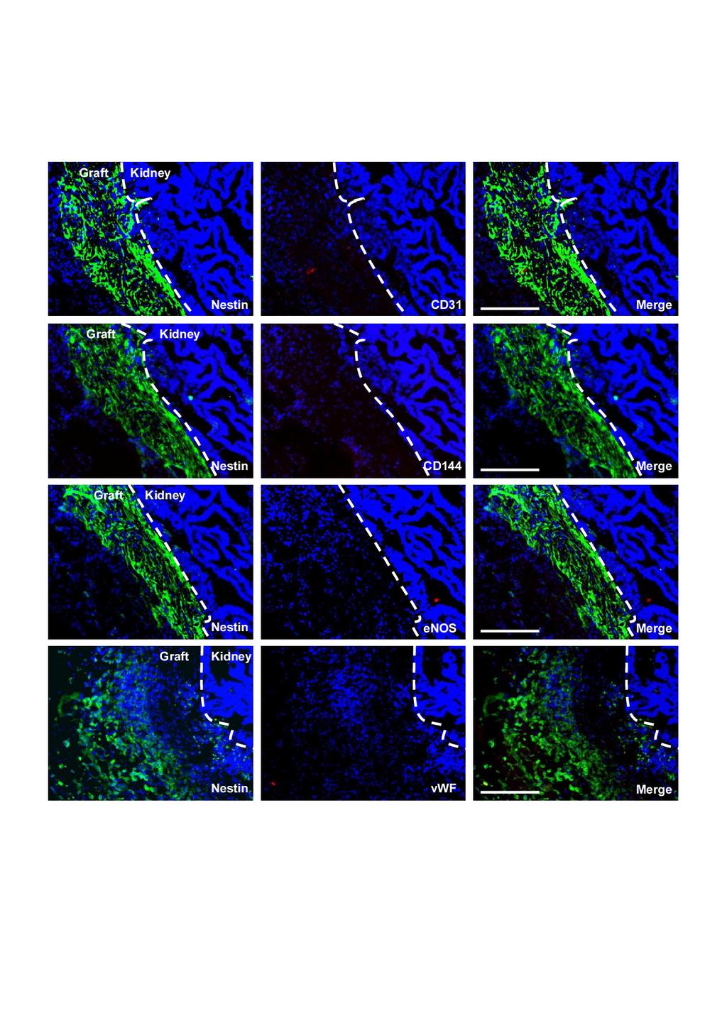 Supplementary Figure 3. Neural grafts do not express antigens considered unique to hesc-derived CD31+CD144+ endothelial progenitor cells.