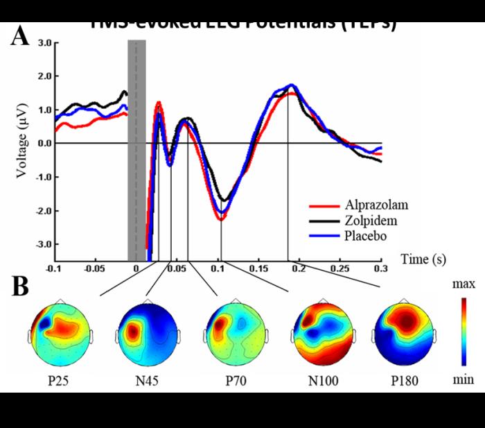excitability EEG: TMS-evoked EEG potentials (TEPs)