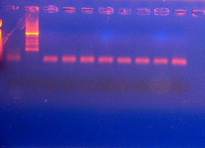 by Real Time PCR and conventional PCR