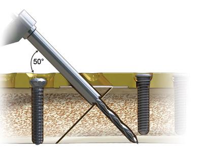 Note: If the angle of the drill is too shallow, the drill may collide with the adjacent screw. Figure 29: 3.