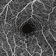 representation of the retinal vasculature in a particular layer of interest.