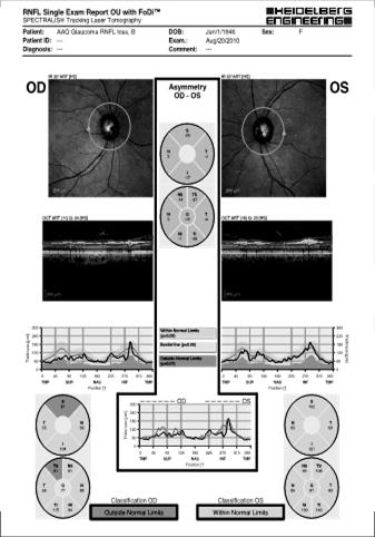 Glaucoma Analysis with the RTVue: