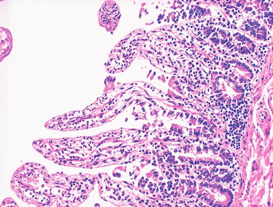 Questions for Fixation A (Histotechnology 4e, i1.5, p 6) B (Histotechnology 4e, i1.11, p 11) 104-118. The following questions refer to images A-E as specified. 104. The tissue shown in image A is: a.