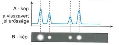 512) 1D lines Shift to the next transducers Ultrasound operation modes A-mode (Amplitude modulated): Single
