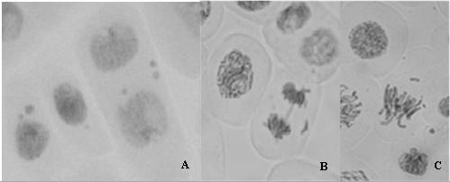 Figure-4. Chromosome abnormalities of gamma irradiated cells at doses of 10, 20, 30, 40, 50, 60, 70 and 80 Gy when cells were fixed 24 hours after exposure (24 hours).