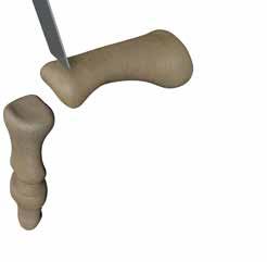 Prepare the pilot holes at the insertion sites 1. Use a microsagittal saw to resect the distal condyles of the proximal phalanx perpendicular to the shaft.