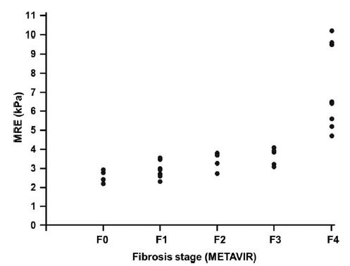 Correlations between MRE and Metavir score in 32 patients