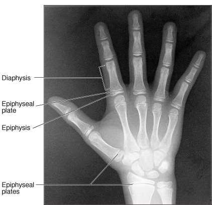Typical Bony Features Epiphysis ends of long bones formed from cancelleous (spongy or trabecular) bone Epiphyseal plate - (growth plate) thin cartilage plate separates diaphysis &