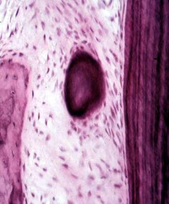 The cementicles appear near the surface of cementum may be free, attached or embedded in the cementum.