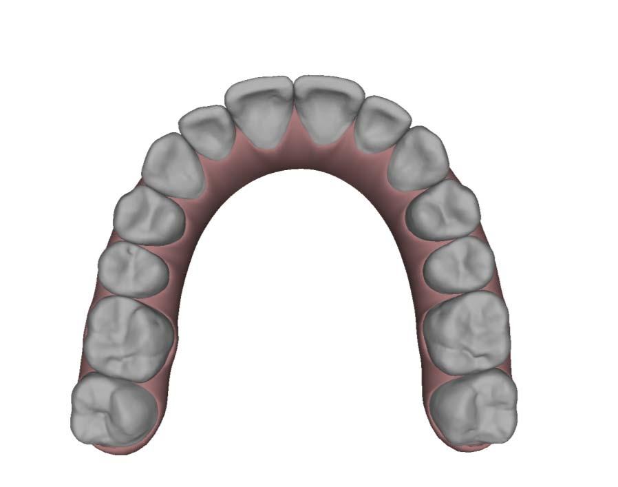 DETECTING TOOTH MOVEMENT OVER TIME