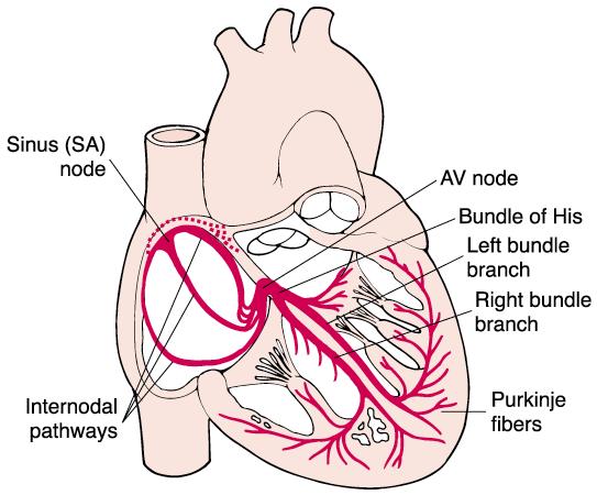 Arrhythmia Study Guide 3 Junctional and Ventricular Rhythms JUNCTIONAL RHYTHMS The AV Junction (Bundle of His and surrounding cells) only acts as pacemaker of the heart when the SA Node is not firing