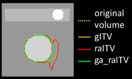 gitv from original volume but also (b) proximal and distal margin in raitv to ga_raitv gitv=geometrical ITV raitv: range adapted ITV ga_raitv=gated raitv 17 Margin