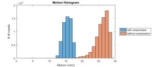 8/3/2016 Histograms of Motion and ΔWEPL WEPL is calculated for each voxel in the ITV for each phase of the 4DCT. ΔWEPL is the difference between the maximum and minimum path lengths.