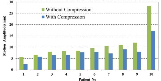 Benefits of Abdominal compression Ratios: without compression belt / with compression belt Pat # Avg Vector Motion Avg ΔWEPL ΔWEPL95 ΔWEPL5mm ITV BSPTV Large/ (mm) Amplitude95 (mm) (mm) (%) /CTV /CTV