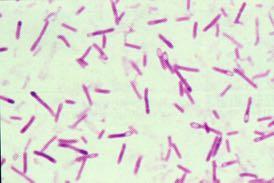 Common diseases contracted Clostridium botulinum via the G.I. Tract Salmonellosis Salmonella sp.