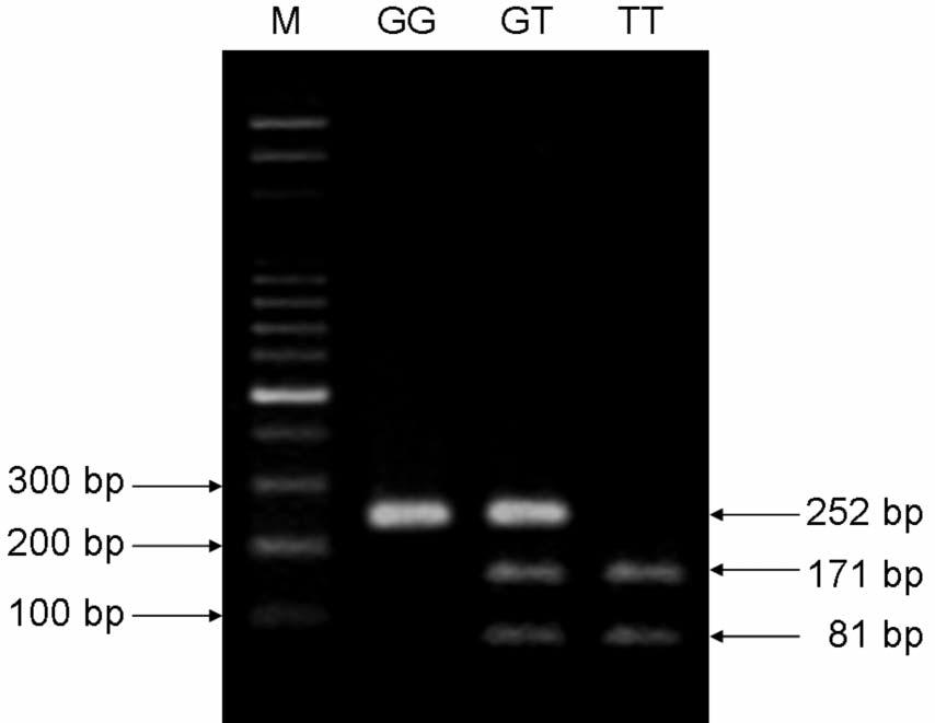 Figure 1. PCR-based restriction analysis of the Ku80 G-1401T polymorphism shown on 2.5% agarose electrophoresis.
