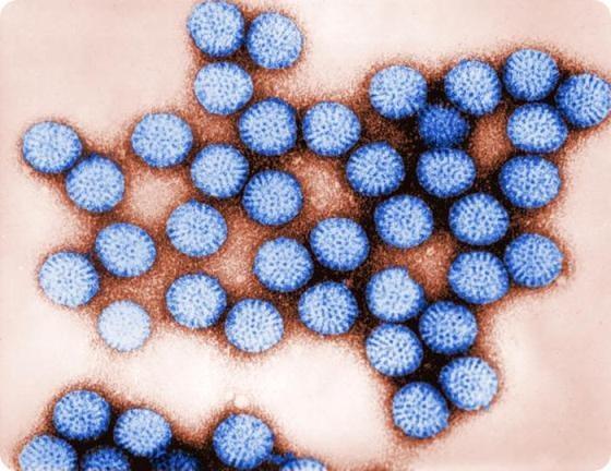 Noroviruses is very contagious and causes gastroenteritis leading to stomach pain, nausea, diarrhea, and vomiting. Diarrheal illness causes 15% of child mortality globally.