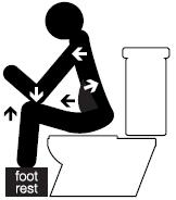 What is constipation? Constipation is common. Usual symptoms include stools (faeces or motions) becoming hard, and difficult or painful to pass.