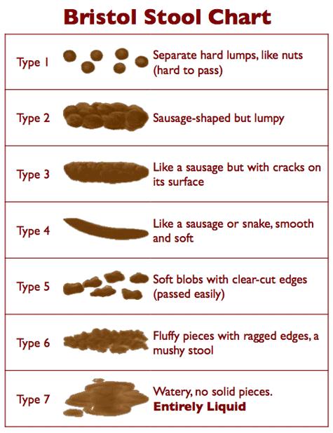 Type 1, 2 or 3 on the Bristol stool chart show some level of constipation. Note: there is a large range of normal bowel habit, from 2-3 times per day to 2-3 times per week.