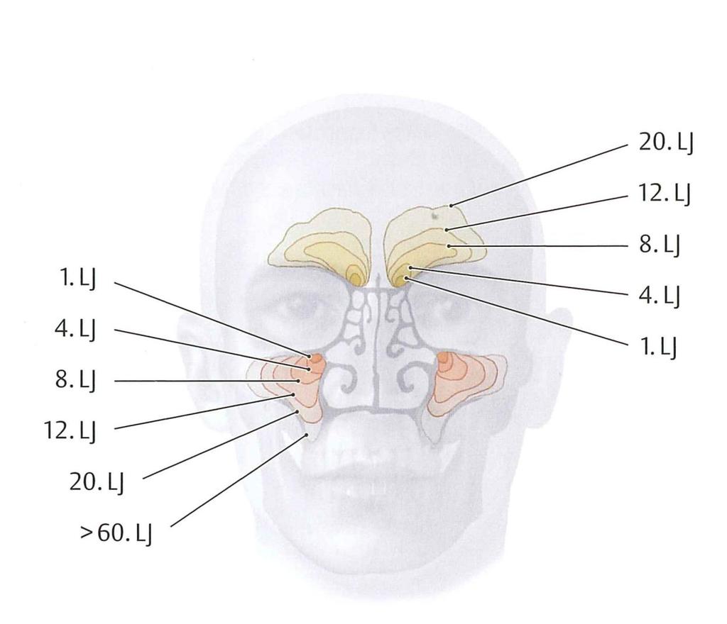 Anatomy Internal Nose Paranasal Sinuses :