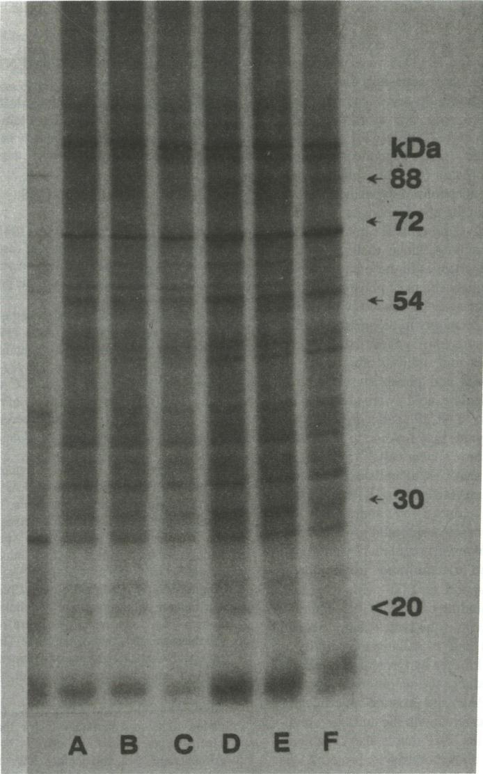 Fig. l. Autoradiogram of LNCaP cells cytosolic phosphorylated proteins separated by SDS-PAGE.
