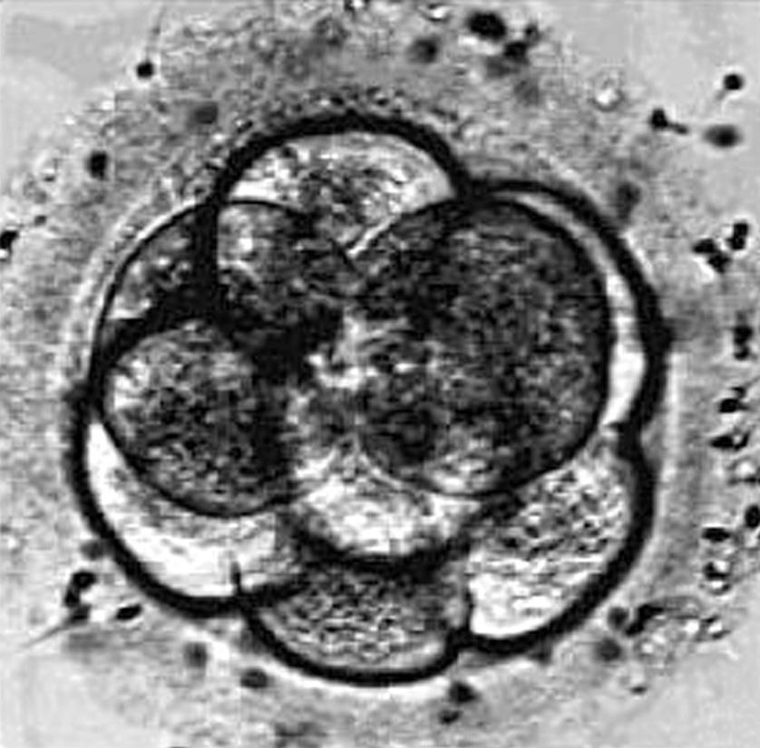 4. Fertilisation of a human egg produces a single cell called a zygote. The zygote soon develops by cell division into an embryo. The photograph below shows a human embryo containing eight cells.