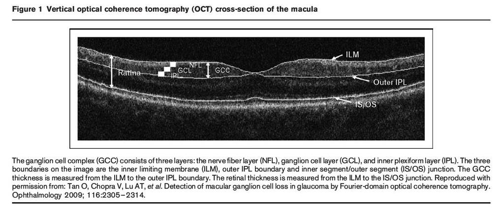 Ganglion cell