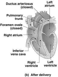 ovalis in adult Ductus arteriosus Between pulmonary trunk and