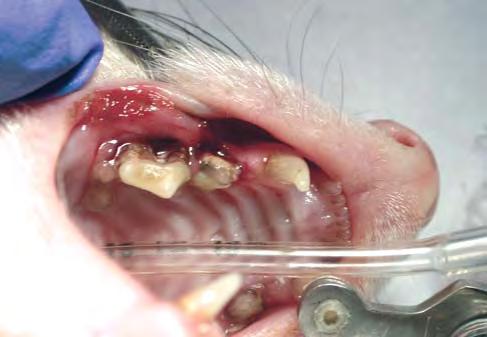 Gumline abscesses may be encountered at this stage. Typically there is swelling as well as some gingival recession or periodontal pocket formation (detected by probing).