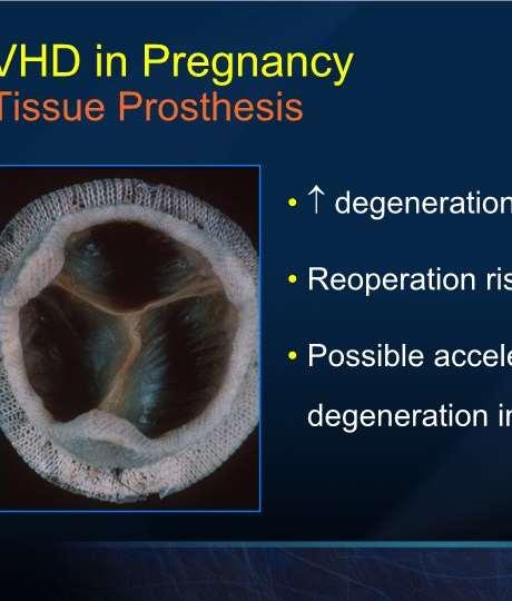 VHD in Pregnancy Tissue Prosthesis Increased degeneration in