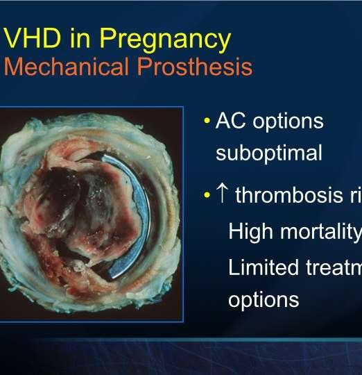 VHD in Pregnancy Mechanical Prosthesis