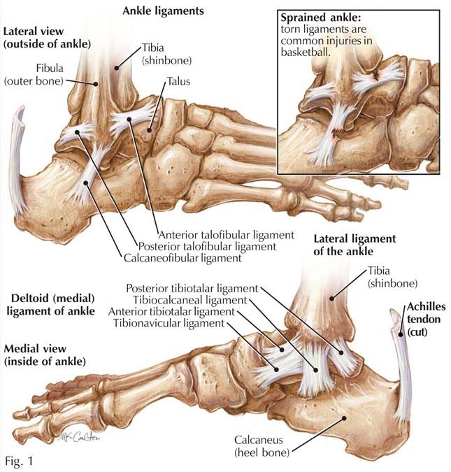 11 Ankle ligament sprains History The mechanism tends to be the same as fractures ie: inversion or eversion injuries, causing strain on the ligaments of the ankle joint This leads to varying degrees