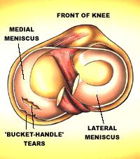 Position of the menisci Cross section of the