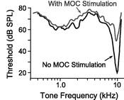Classic effects of olivocochlear bundle stimulation on auditory nerve responses MOC stimulation alters auditory nerve firing to