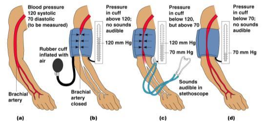 Measuring Arterial Blood Pressure Tutorial Variations in Blood Pressure Human normal range is variable Normal 140 110 mm Hg systolic 80 75 mm Hg diastolic Hypotension Low systolic (below 110 mm HG)