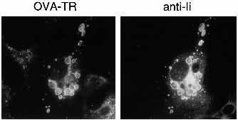 After fixation and permeabilization antigens were labelled using rabbit anti-human transferrin antibody (anti-tf) followed by Texas Redconjugated second antibody, and anti-ii mab LN2 followed by