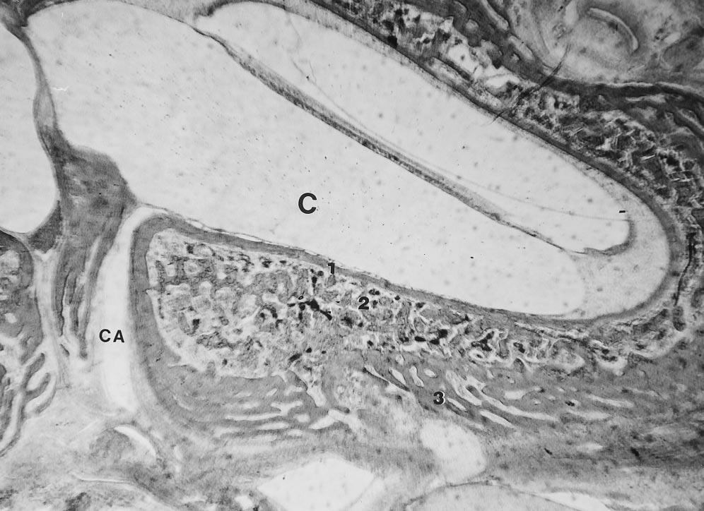 AJNR: 17, September 1996 TEMPORAL BONE 1475 Fig 11. Fetus, gestational age 26 weeks. Histologic section shows the cochlear aqueduct at the basilar turn of the cochlea.