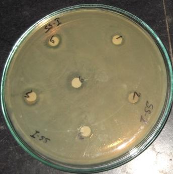 The bacterial strains were grown in Mueller-Hinton agar (MHA) plates at 37 C (the bacteria were grown in the nutrient broth at 37 C and maintained on nutrient agar slants at 4 C), whereas the fungi