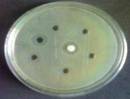 Antimicrobial Activity Determination of zone of inhibition method Preparation of Discs Whatman No: 1 filter paper discs of 6mm diameter are prepared and autoclaved by keeping in a clean and dry Petri