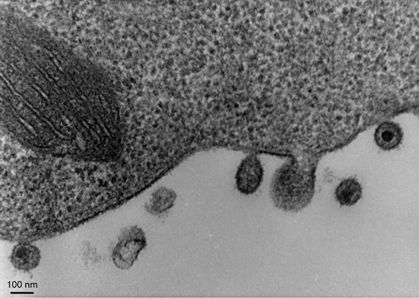 Electron Micrograph Showing Mature HIV Particles Courtesy of