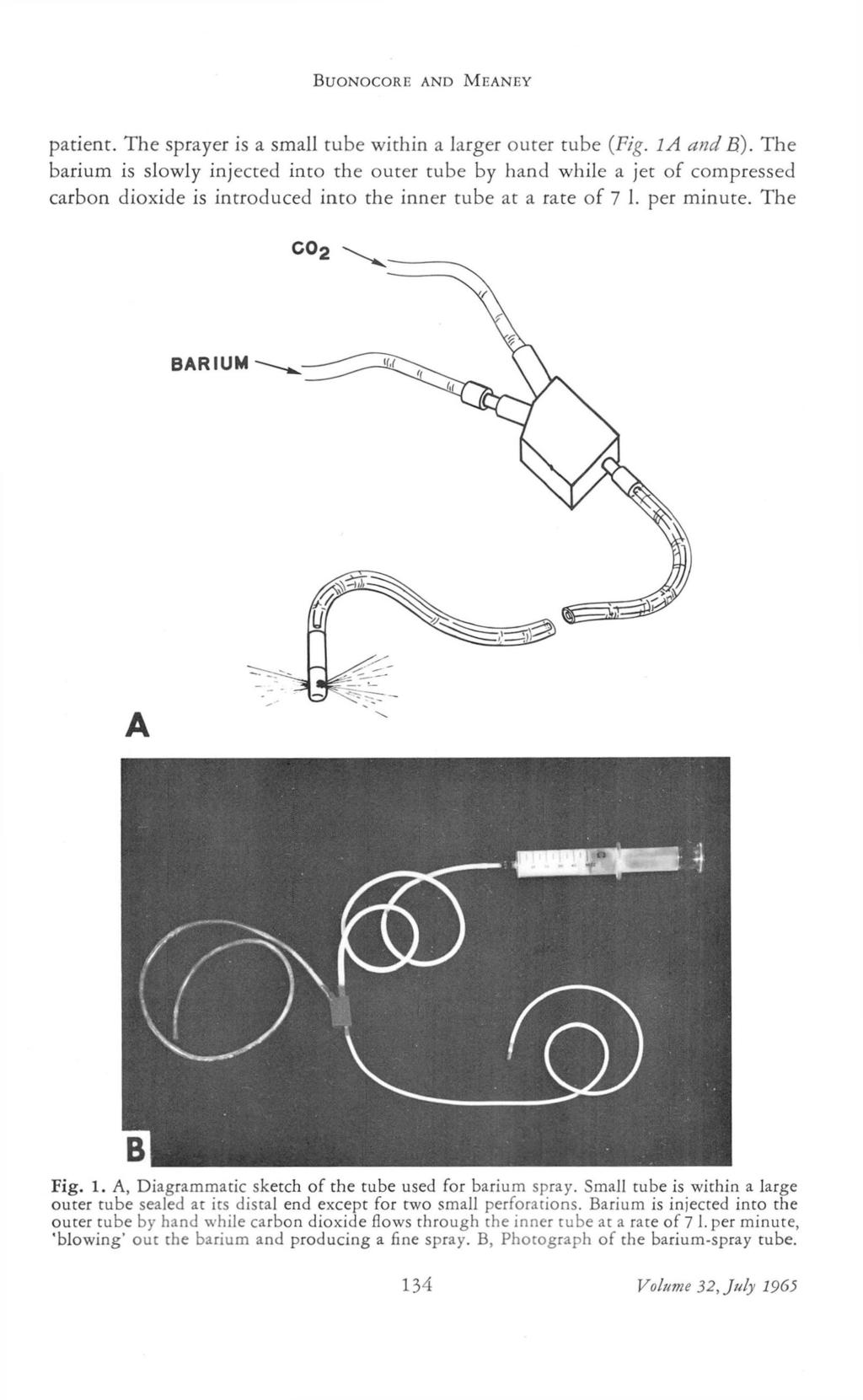BUONOCORE AND MEANEY patient. The sprayer is a small tube within a larger outer tube (Fig. la and B).