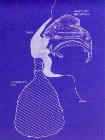 Non-rebreathing mask flow
