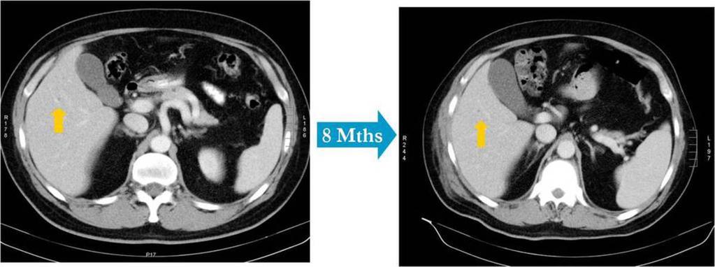 STUDY RESULTS Of 1192 CT scans, 564 (47%) patients had multiple contrasted scans.