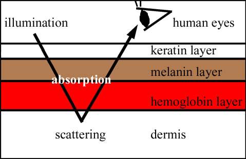 2 The origins of skin colors [1-3] In short, illuminated light which comes into the skin is scattered in the dermis and a part of it is absorbed by melanin and hemoglobin, then the rest of the light