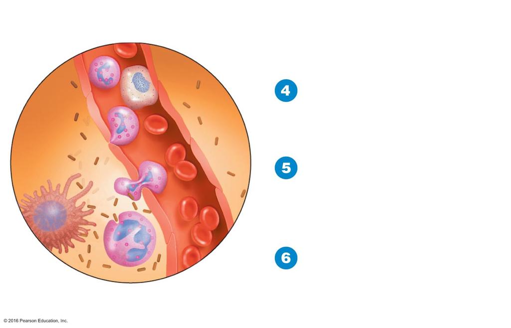 Figure 16.9b The process of inflammation.